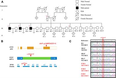 A homozygous missense variant in DND1 causes non-obstructive azoospermia in humans